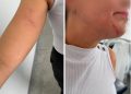 Rondonópolis|Secretaria de Saúde repudia agressões contra auxiliar de saúde bucal