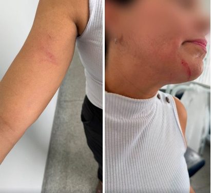 Rondonópolis|Secretaria de Saúde repudia agressões contra auxiliar de saúde bucal